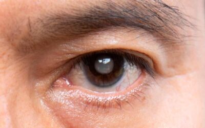 Las 3 principales causas de ceguera en México: un reto de salud pública