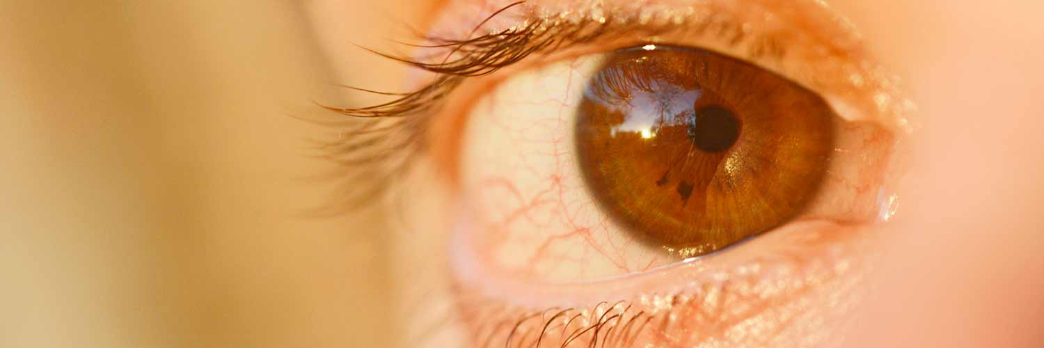 ¿Cuánto dura un transplante de córnea?