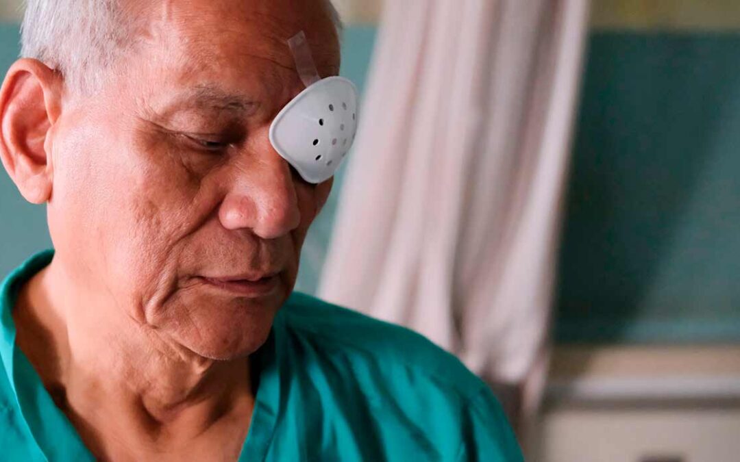 ¿Cuántas cirugías de catarata necesita México cada año?