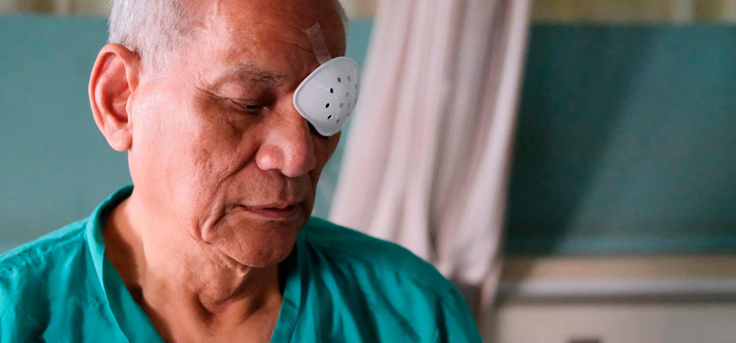 ¿Cuántas cirugías de catarata necesita México cada año?