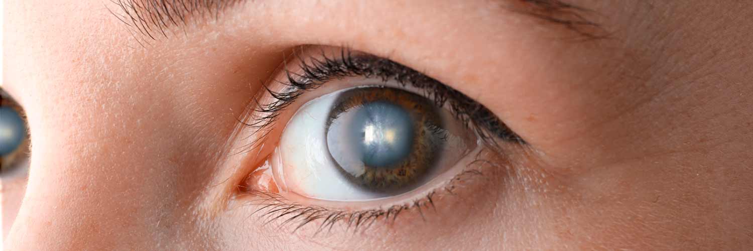 Importancia del Cross-Linking