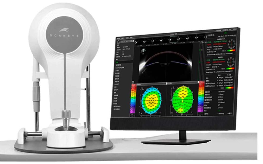 Topografía corneal Scheimpflug: tecnología 3D para diagnosticar queratocono y planear cirugías con precisión