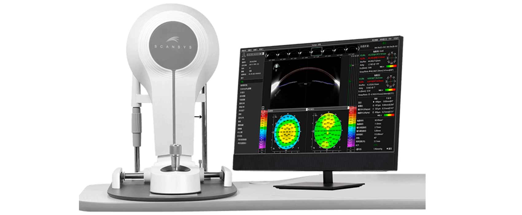 Topografía corneal Scheimpflug: tecnología 3D para diagnosticar queratocono