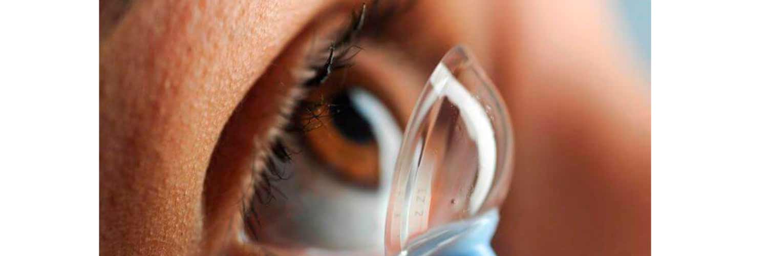 Topografía corneal Scheimpflug: tecnología 3D para diagnosticar queratocono