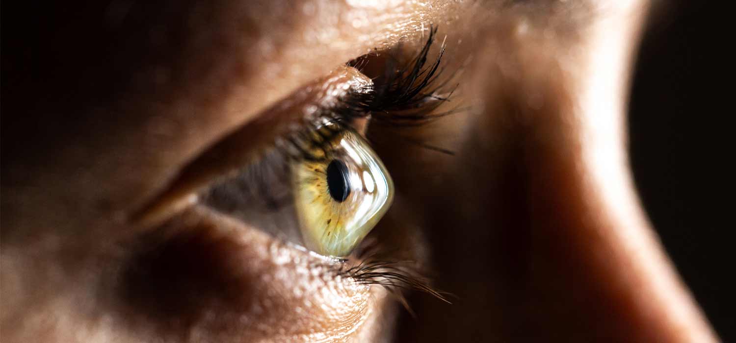 Ectasias corneales: qué son, síntomas, diagnóstico y tratamiento