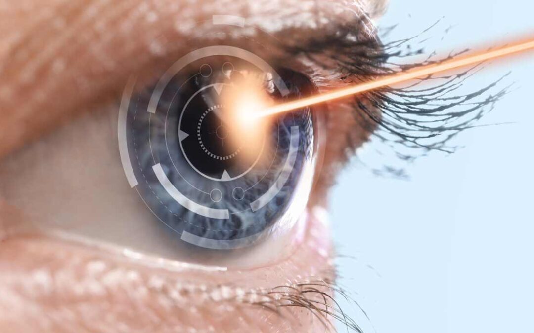 Facoemulsificación: La Cirugía de Catarata sin Bisturí