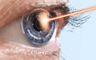 Facoemulsificación: La Cirugía de Catarata sin Bisturí