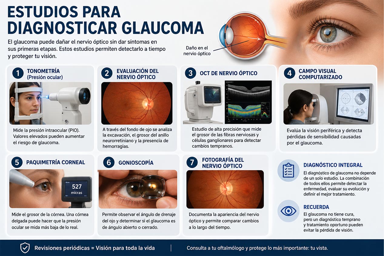 estudios para el glaucoma